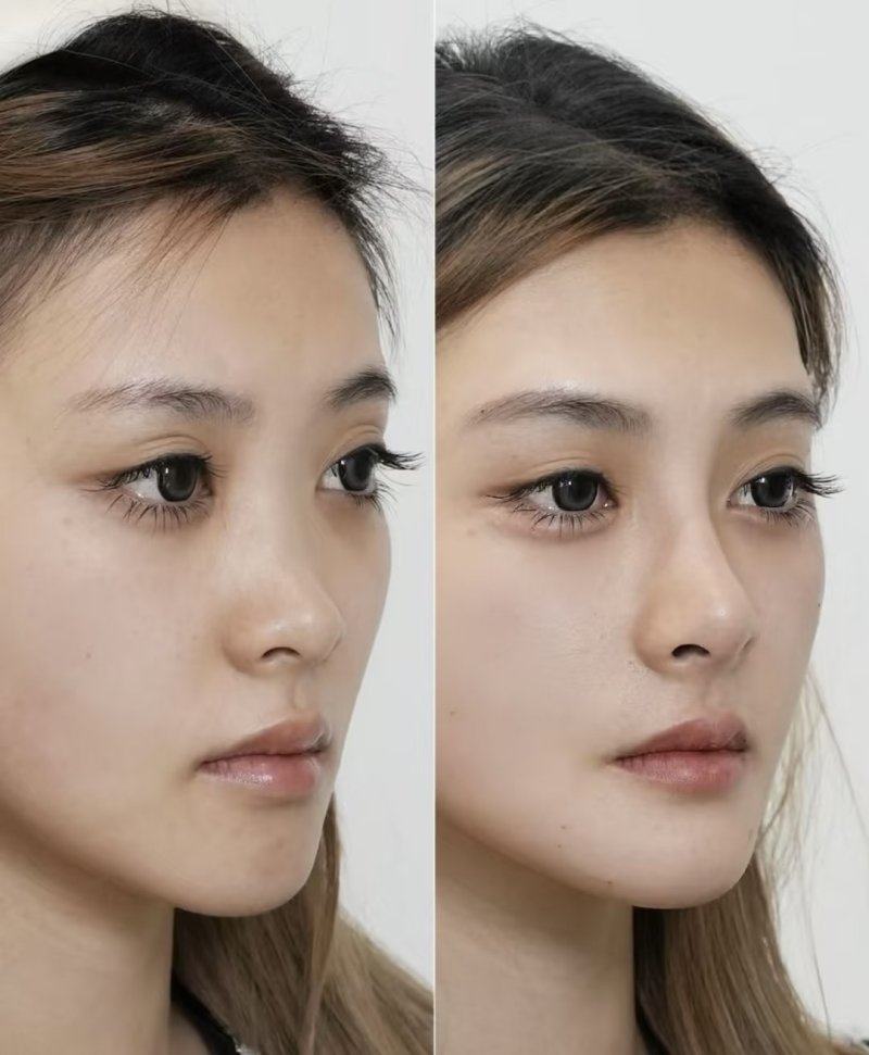 启东柠菲绎美整形医院口碑评价