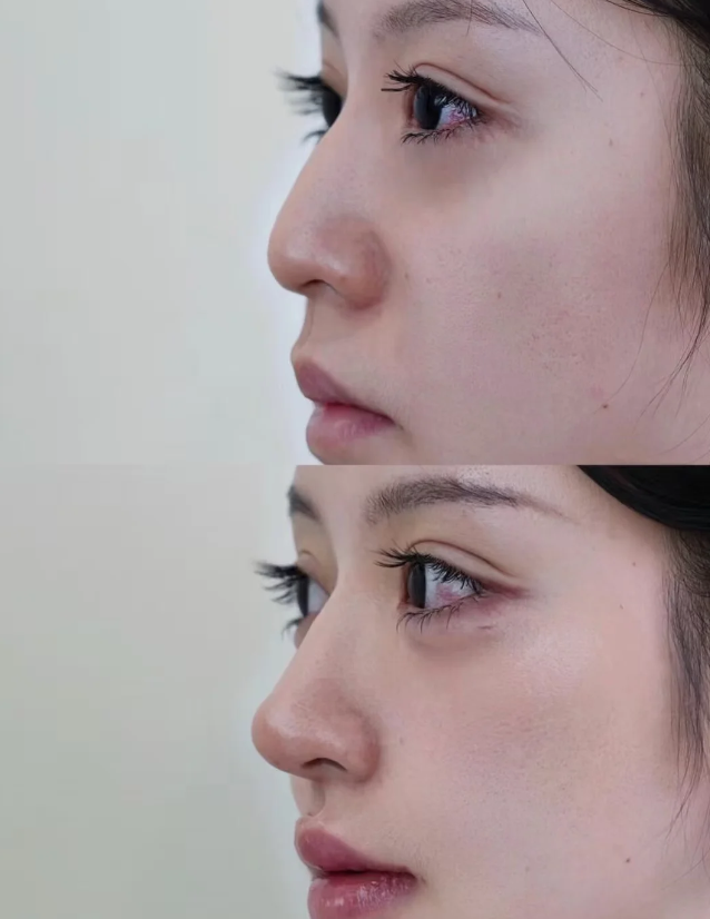 启东柠菲绎美整形医院地址电话及营业时间