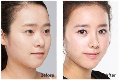 福州格莱美整形医院口碑评价