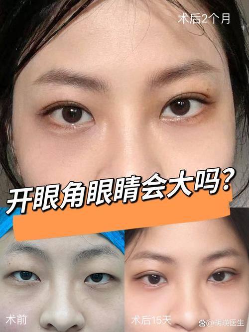 福州格莱美整形医院擅长项目