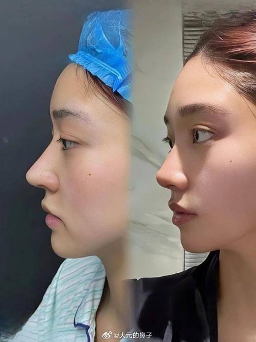 福州格莱美整形医院怎么样？