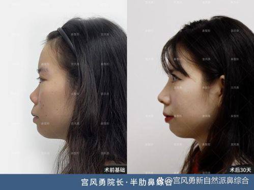 南京东南美容医院口碑评价：