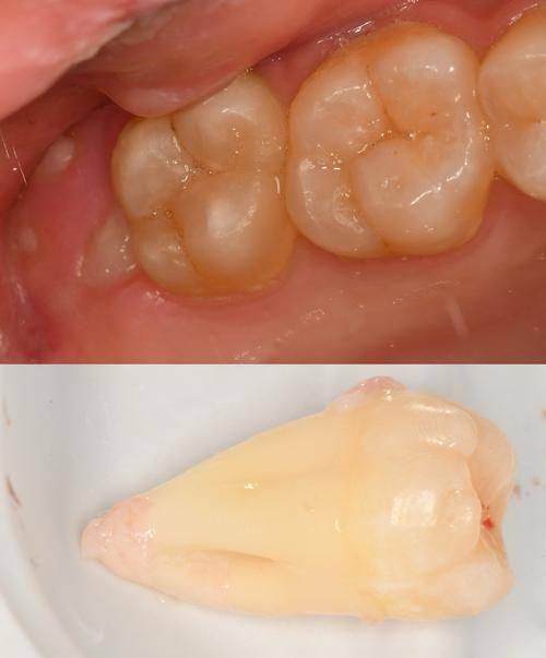 北京佳美口腔西坝河门诊口碑评价