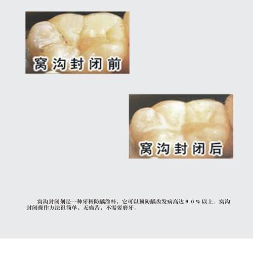 河南许昌小白象口腔门诊部价格表：