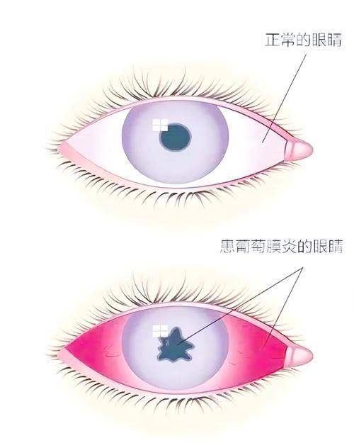 乌鲁木齐市中医院眼科价格表：