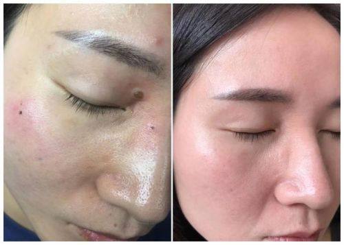 福州格莱美整形医院预约挂号方式