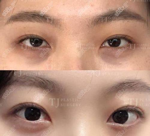 刘昕医生怎么预约