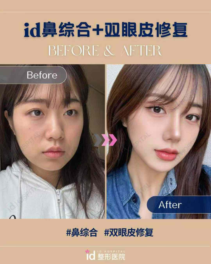 刘昕医生口碑评价