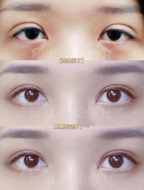 延安大学附属医院烧伤整形科口碑评价：