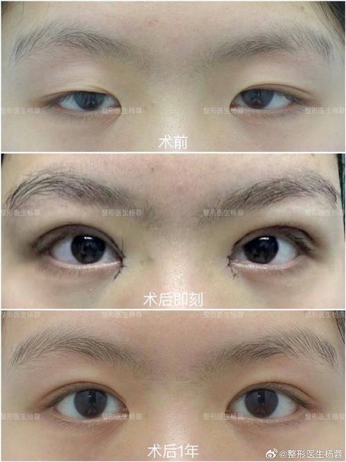 延安大学附属医院烧伤整形科地址电话及营业时间：