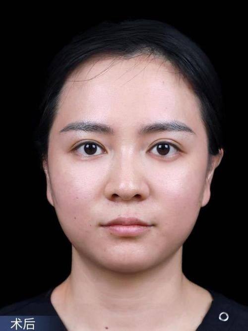 延安大学附属医院烧伤整形科预约挂号方式：