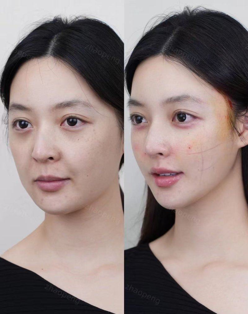 延安大学附属医院烧伤整形科价格表：