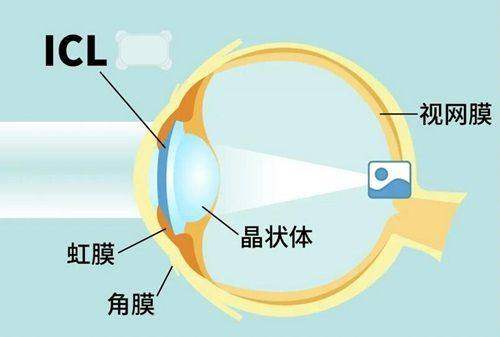 深圳罗湖区人民医院眼科