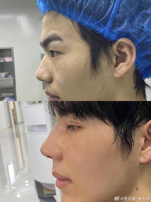 李晓丹医生怎么预约