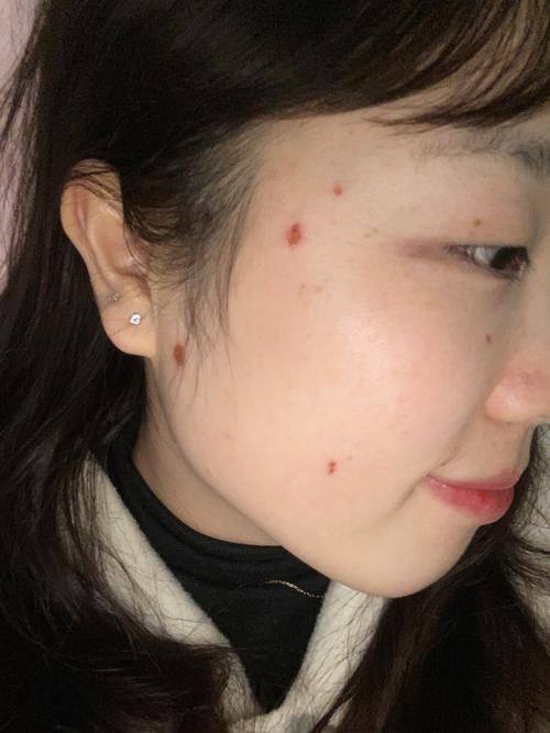 赵设计医生技术优势：