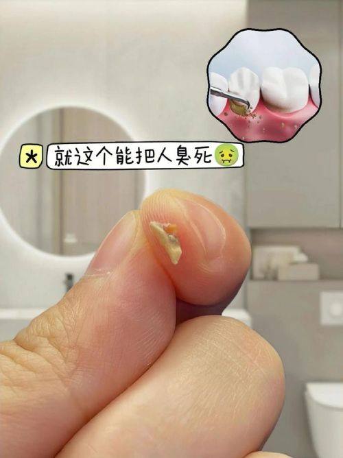 广东肇庆端州德健口腔擅长项目