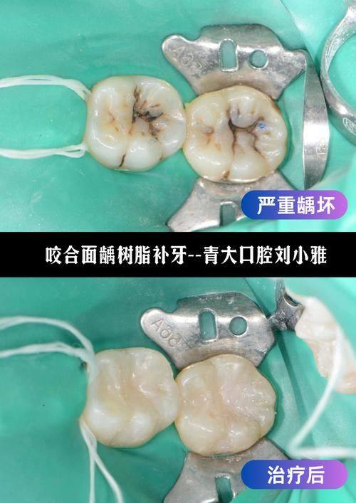 广东肇庆端州德健口腔预约挂号方式