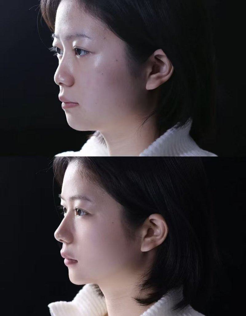 新乡名门整形医疗美容怎么样？