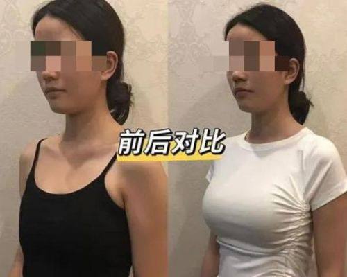 哈医 大四院整形美容激光中 心地址电话及营业时间