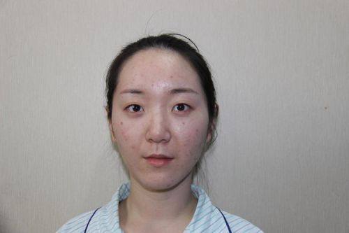 曹景敏医生技术优势