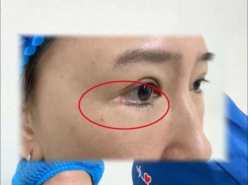 深圳柏伊美医疗美容门诊部价格表：