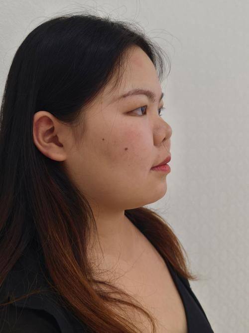 哈医 大四院整形美容激光中 心预约挂号方式