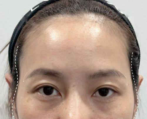 哈医 大四院整形美容激光中 心擅长项目