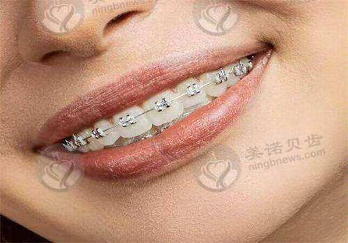 南充极色口腔诊所更擅长什么