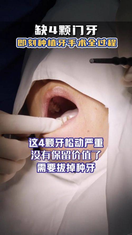 陈孝师医生擅长领域