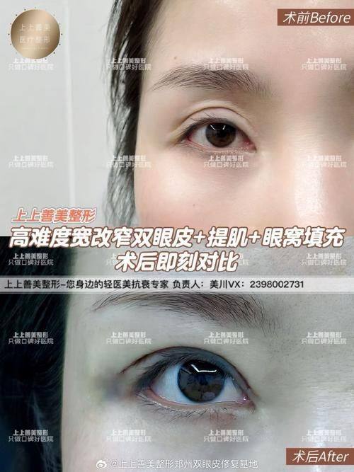 驻马店华美医疗美容医院医生名单及擅长领域：
