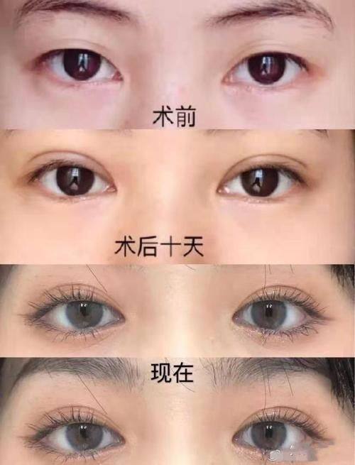 钟子敏医生技术优势