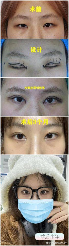 驻马店华美医疗美容医院地址电话及营业时间：