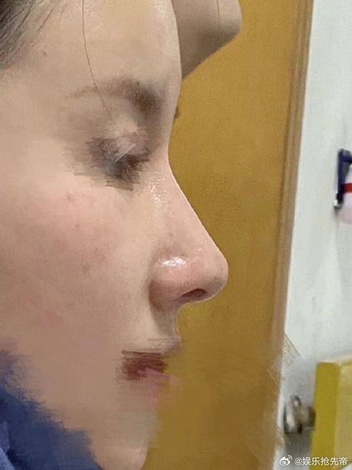 重庆白领医疗美容诊所擅长项目：