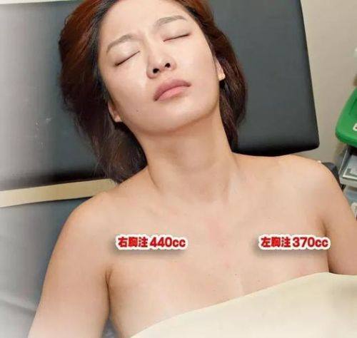 驻马店华美医疗美容医院擅长项目：