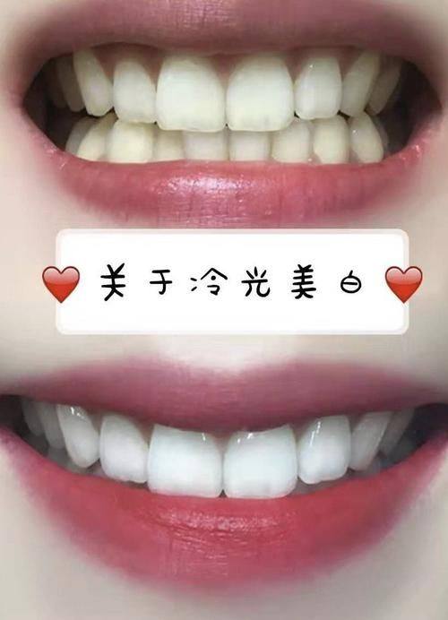 广州暨广口腔门诊部医生名单及擅长领域
