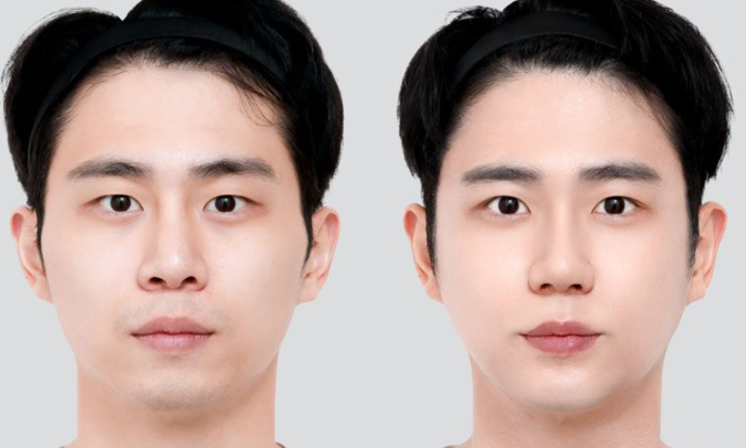 重庆白领医疗美容诊所怎么样？