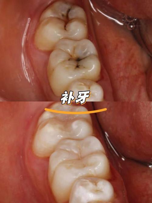 济源合诺口腔门诊部擅长项目：