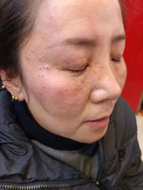 成都玺悦妍医疗美容诊所预约挂号方式