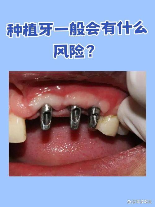 深圳元亨口腔连锁(皇庭店)擅长项目