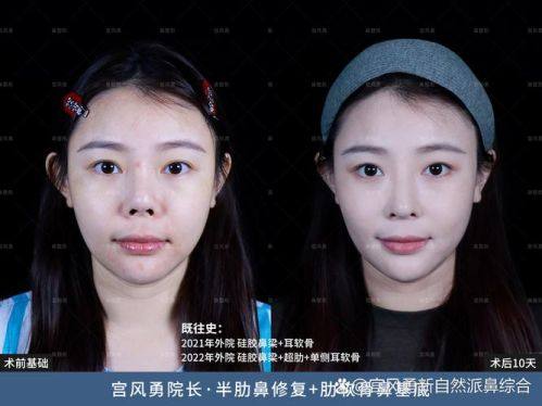 内蒙古医 科 大学附属医院整形美容烧伤科怎么样？