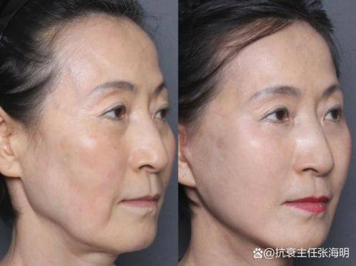 内蒙古医 科 大学附属医院整形美容烧伤科价格表：