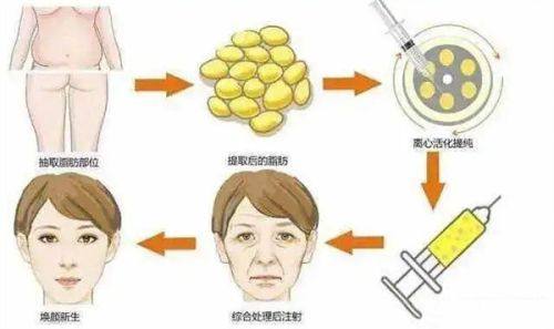 王艳方医生技术优势
