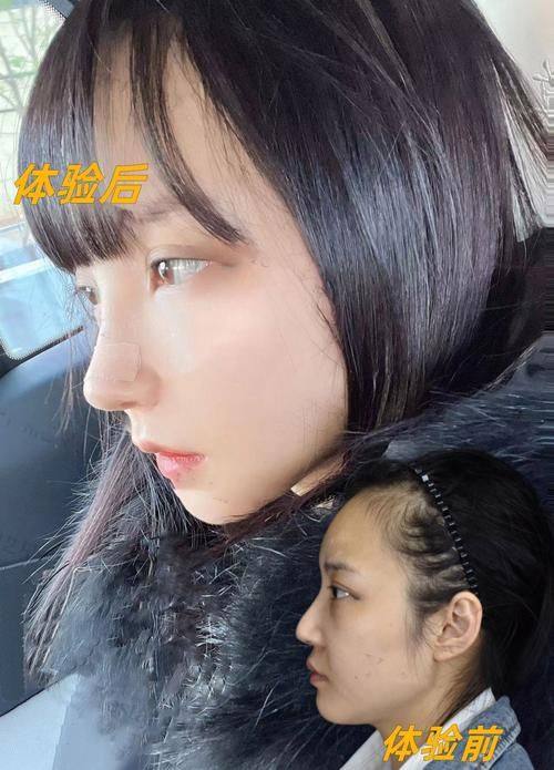 柳超医生口碑评价