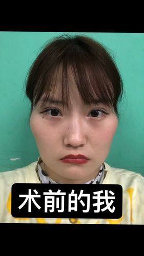 柳超医生擅长领域