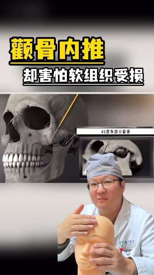 柳超医生技术优势