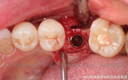 浙江温州永嘉李伟璞口腔口碑评价：