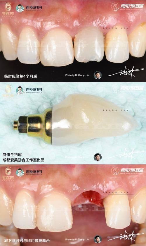 上海茂齿口腔擅长项目：