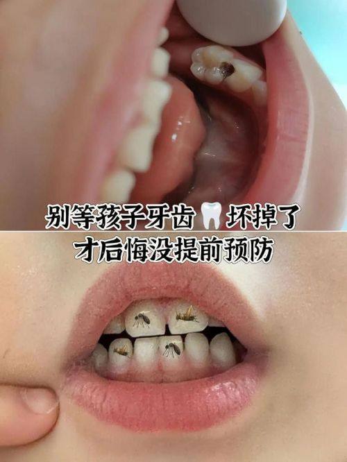 上海茂齿口腔预约挂号方式：