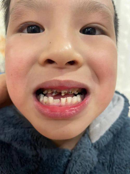 浙江温州永嘉李伟璞口腔价格表：