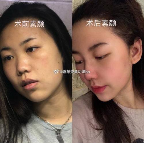 贵州贵阳北科云蔓整形医院怎么样？